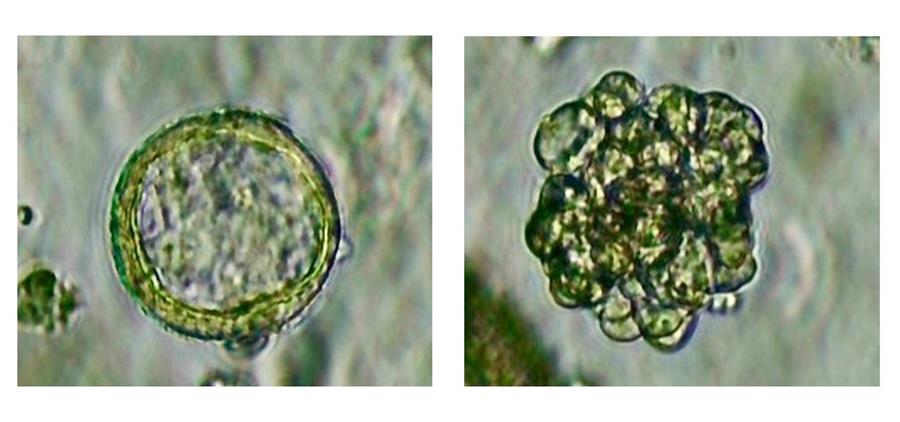 Wat microplastics doen met onze longen
