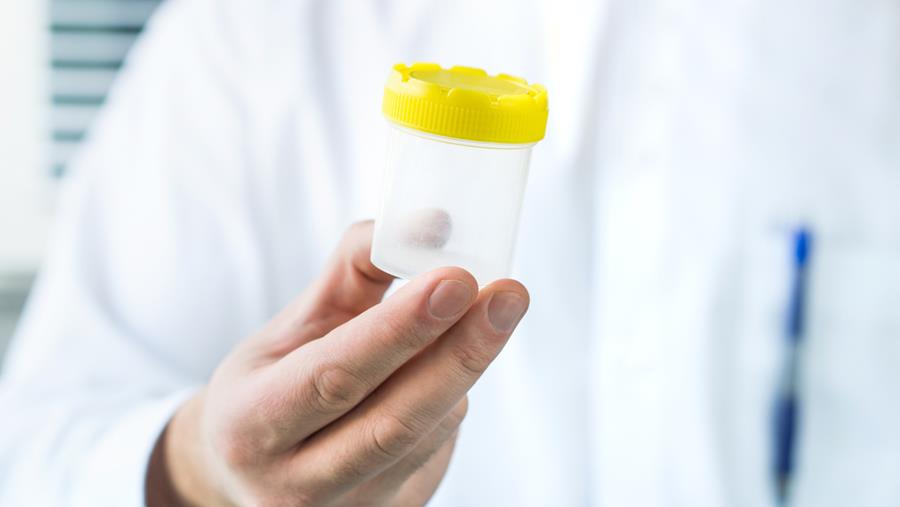 Le conseil des ministres donne son feu vert à la fin des dons anonymes de sperme