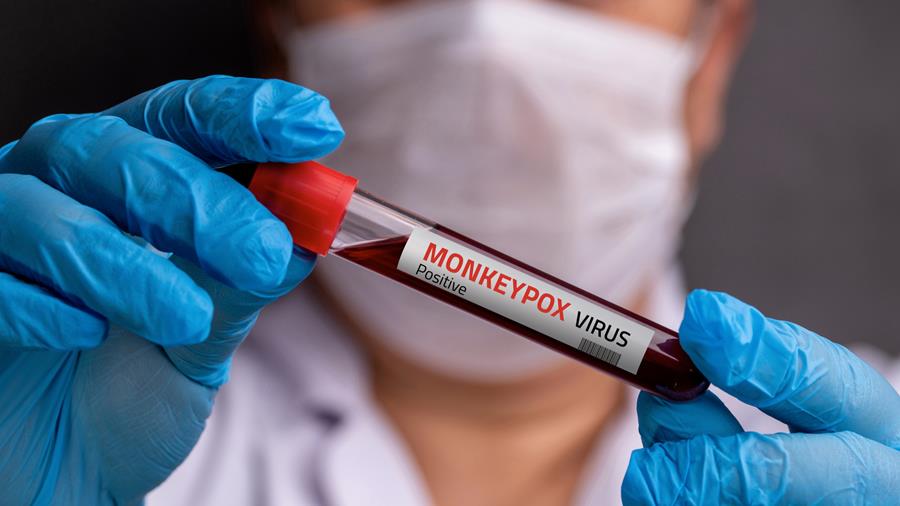 Mpox : les personnes infectées davantage protégées à long terme